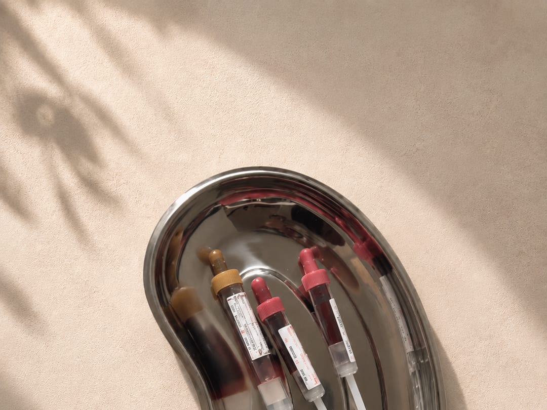Blutröhrchen für eine Blutanalyse